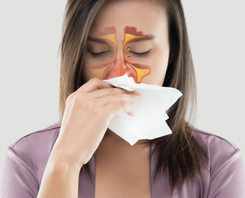 Woman suffering from allergies.